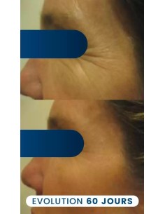 Collagène végétarien 2