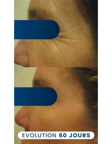 Collagène végétarien