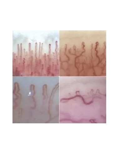 CAPILLAROSCOPE, le microscope capillaire